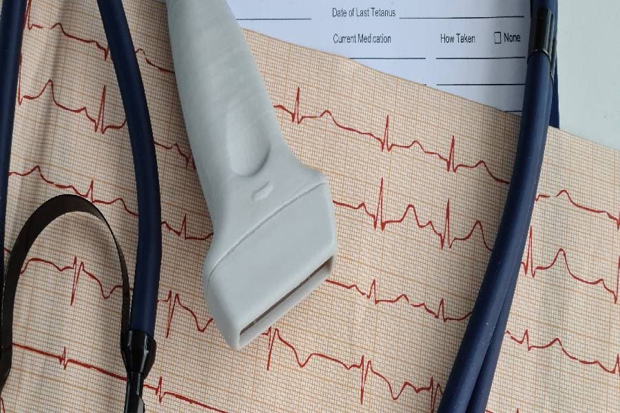 Examination table with echocardiogram instruments and reading