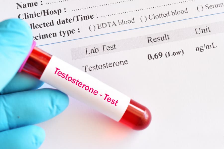 Blood sample and testosterone test sheet indicating low-T in male patient