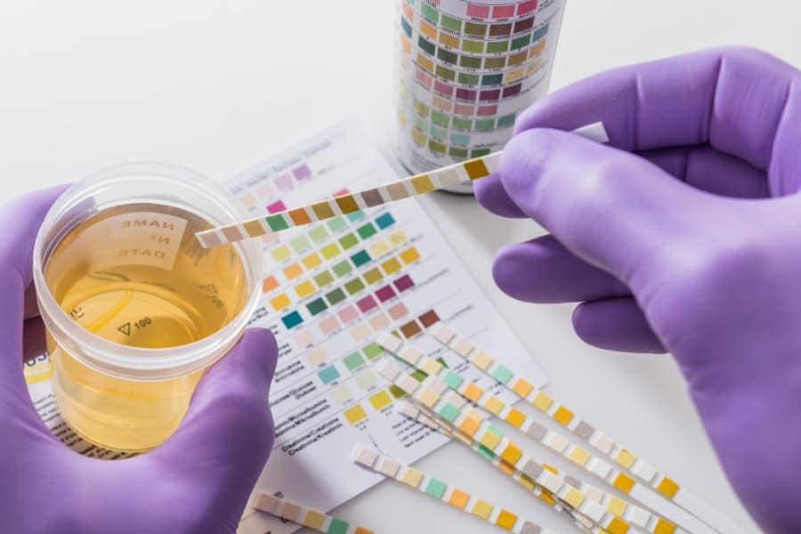 Urine sample and test strips