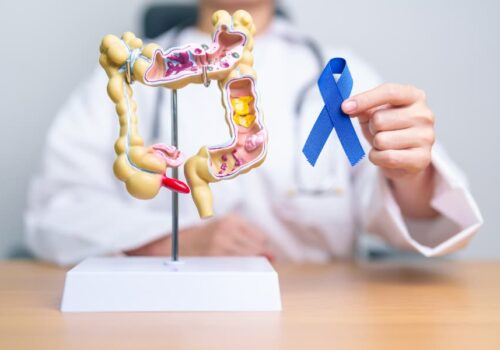 Key Recommendations About Colorectal Cancer