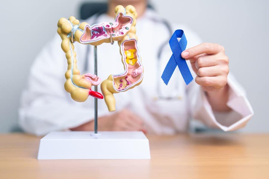Doctor holding blue cancer awareness ribbon next to model of colon