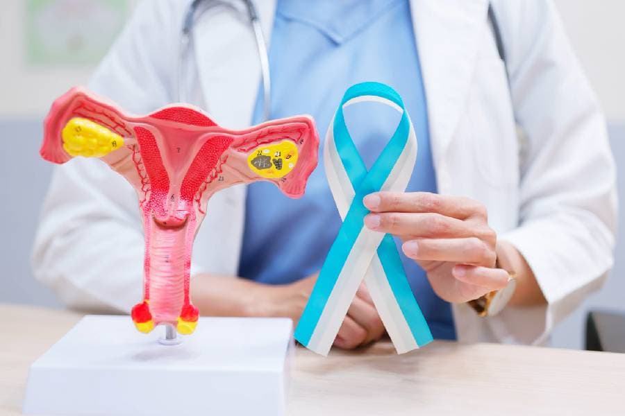 Doctor showing medical model and teal ribbon for uterine cancer awareness