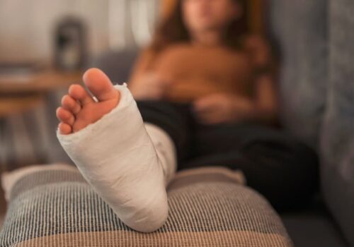 How Long Does It Take to Recover from Orthopedic Surgery?